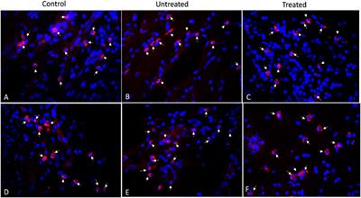 Novel patch biomaterial treatment for colon diverticulosis in swine model